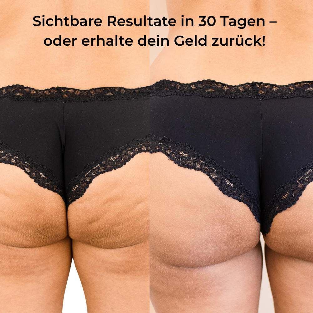 Steinsee Cellulite-Massage Pro